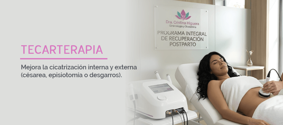 Programa Integral de Recuperacion Postparto Bogota 17