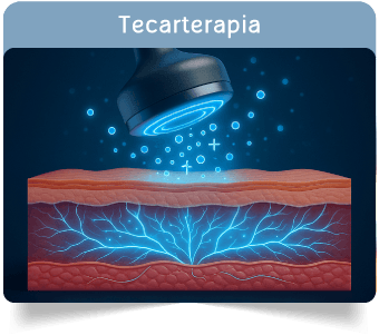 Tecarterapia